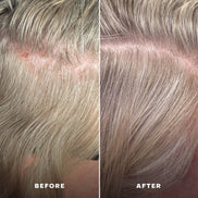 EVERIST Scalp Serum | EverBoost for Dry and Brittle & Thinning Hair
