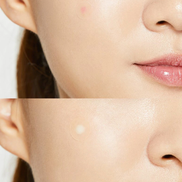 COSRX Acne Pimple Master Patch kbeauty